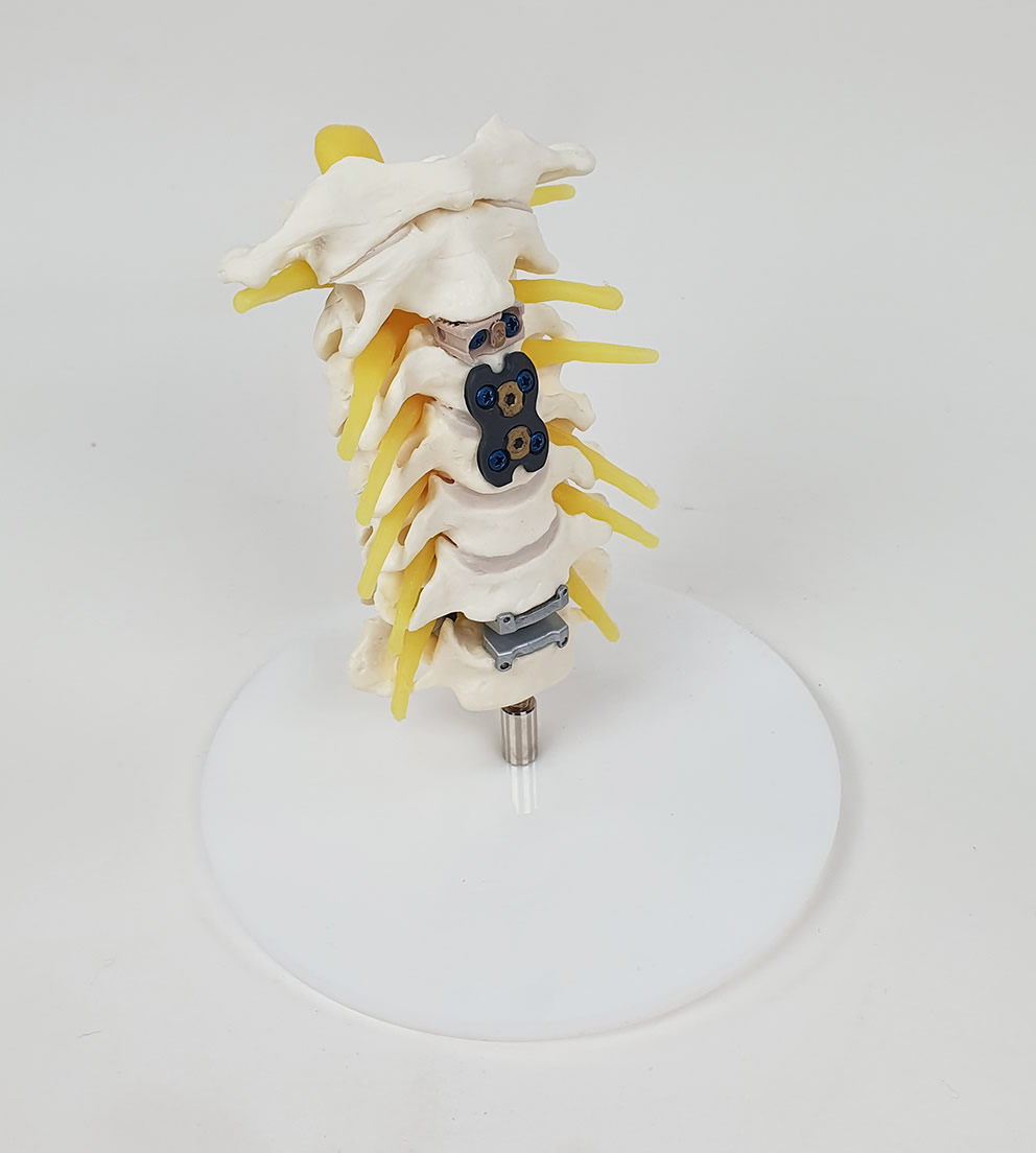 Cervical Spine Model - SINI Medical Simulation