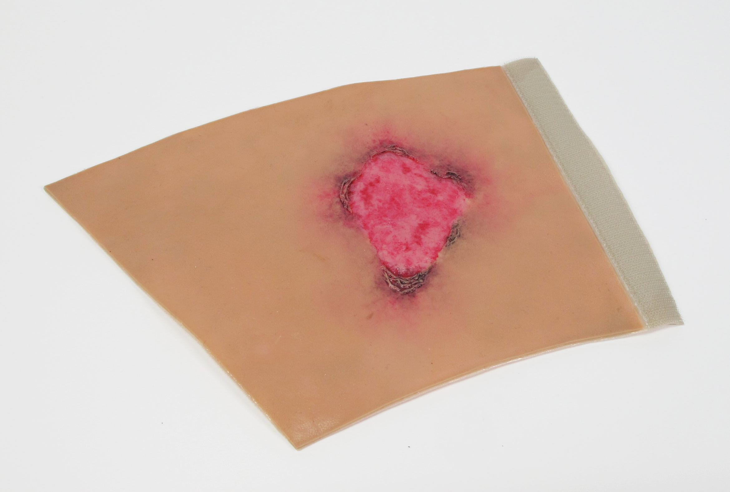 Burn Treatment Model SINI Medical Simulation