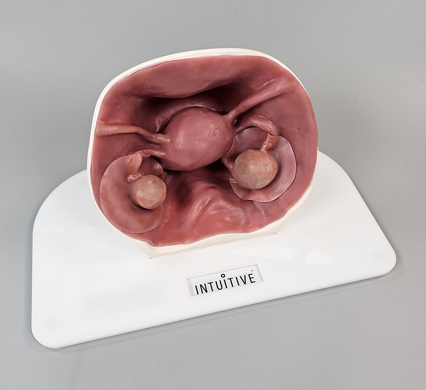 Ovarian cystectomy trainer sini medical simulation